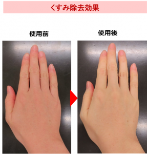 使用前後のくすみ除去効果