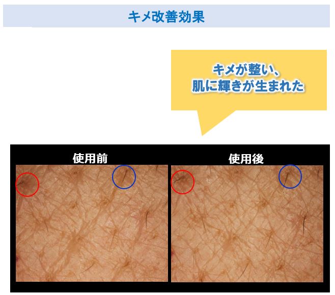 キメを改善し肌に輝きが生まれる効果