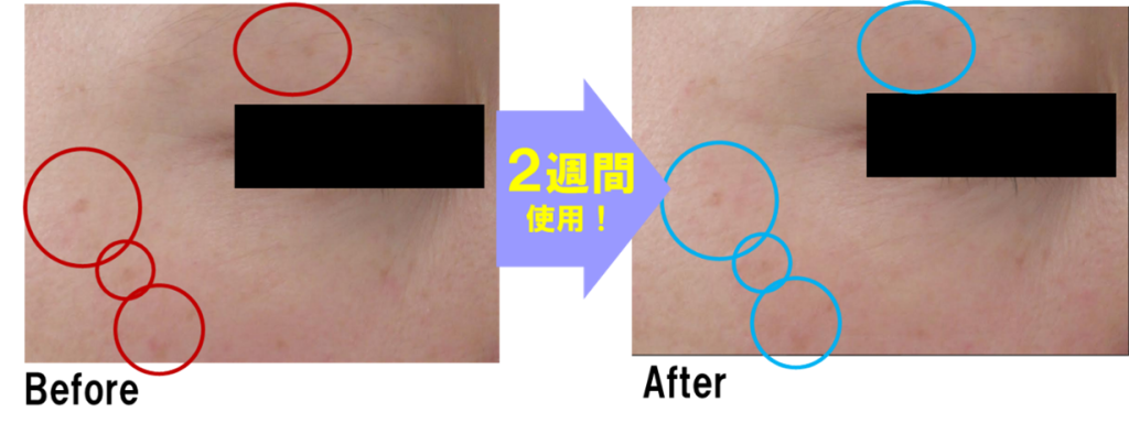 2週間でシミが薄くなる効果