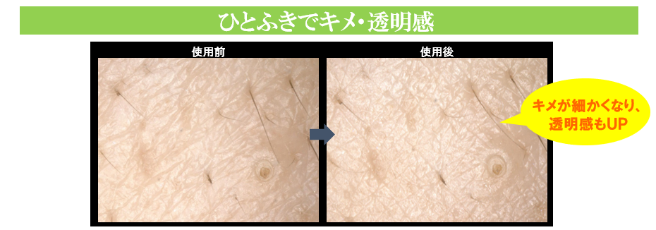 キメと透明感をアップさせる効果