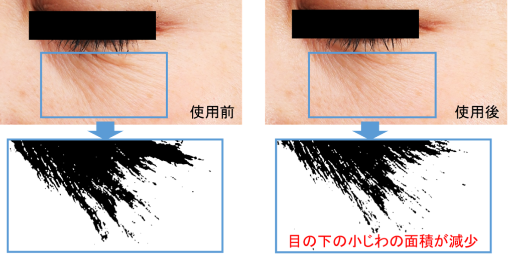 目もとの小じわ改善効果
