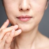 肌悩みのある女性