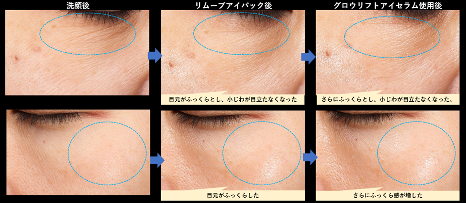 効能効果試験で目元の小じわが目立たなくなった写真