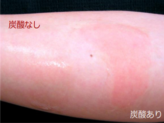 血流が促進して赤くなっている腕