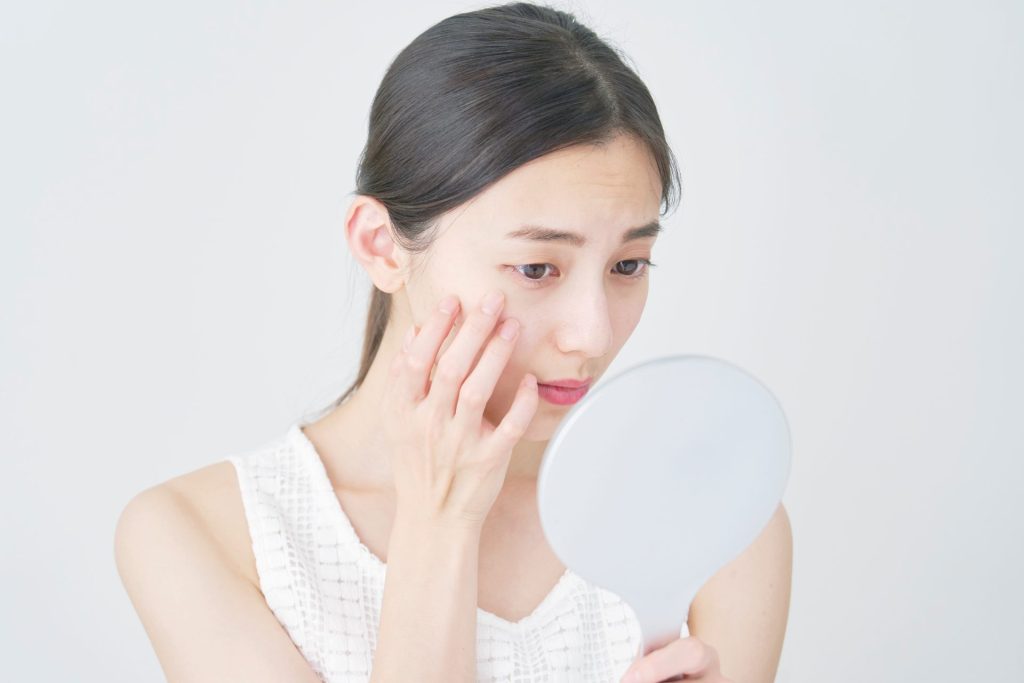 肌悩みを抱えた女性