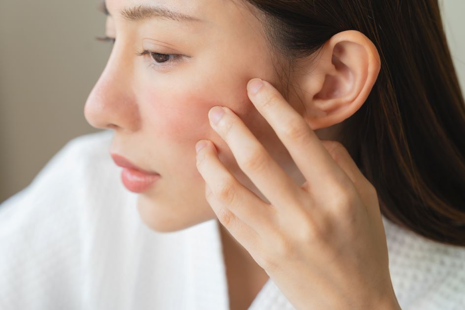 肌の赤みを気にする女性