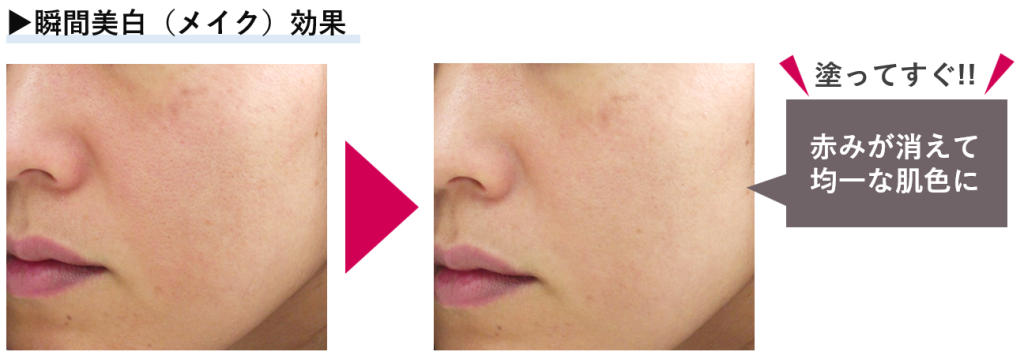 瞬間美白効果の肌