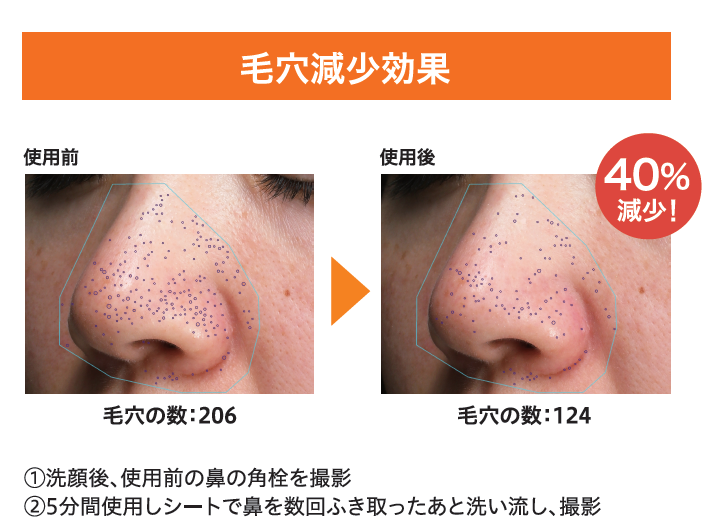 毛穴減少試験の効果データ