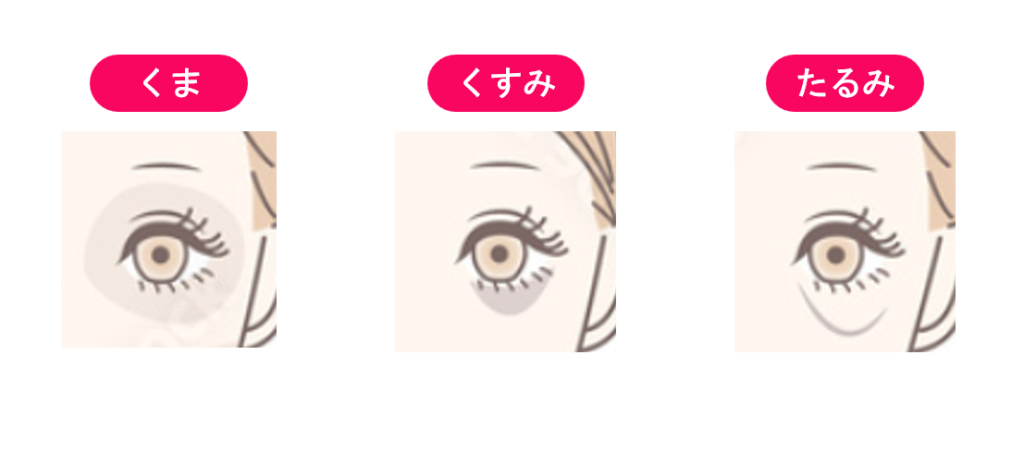 くま・くすみ・たるみのイメージ画像