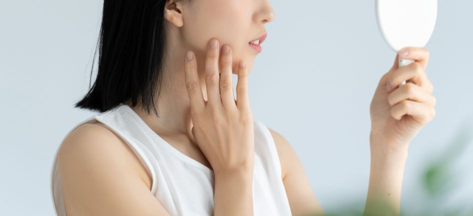 肌悩みを抱える女性