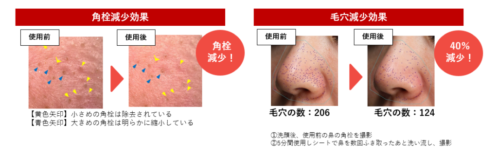 角栓と毛穴減少の効能効果試験データ